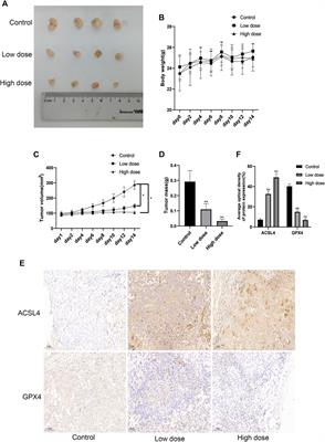 Surufatinib combined with photodynamic therapy induces ferroptosis to inhibit cholangiocarcinoma in vitro and in tumor models
